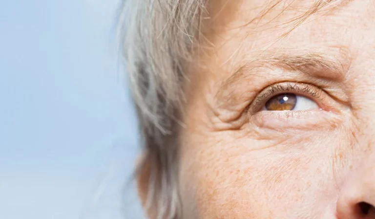 Alzheimer's Disease And Vision Impairment