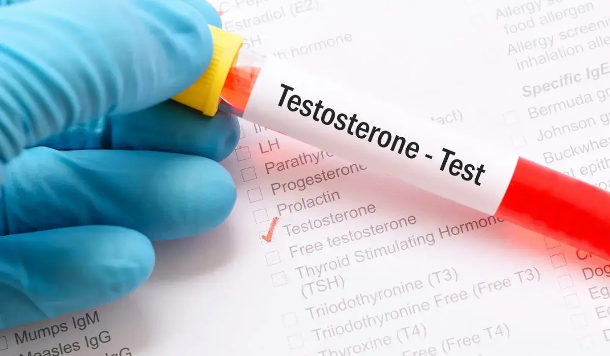 Low Testosterone test